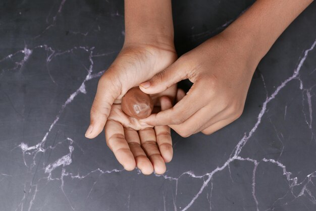 Suche dłonie od czego mogą się pojawić?