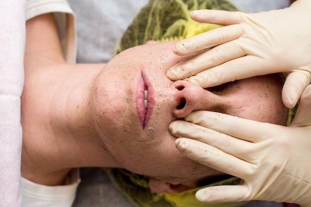 Jak powstają zaskórniki i dlaczego pojawiają się na skórze?