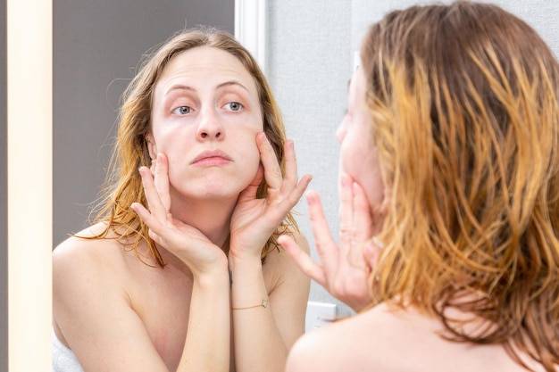 Jak pozbyć się schodzącej skóry z twarzy?