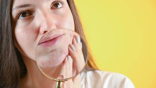 Rozszerzone pory jak się pozbyć tego problemu?